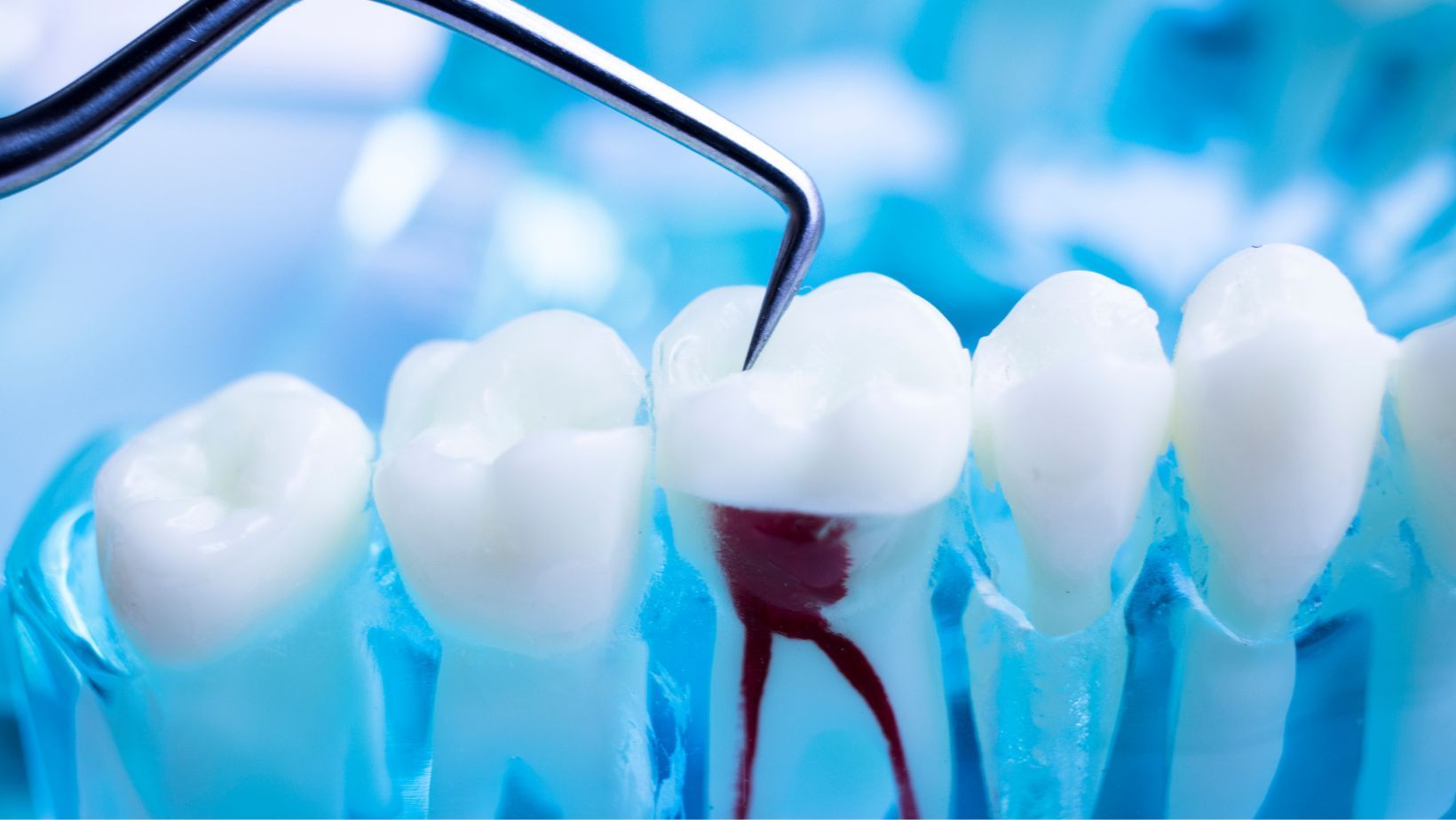 calidad de los materiales del laboratorio dental